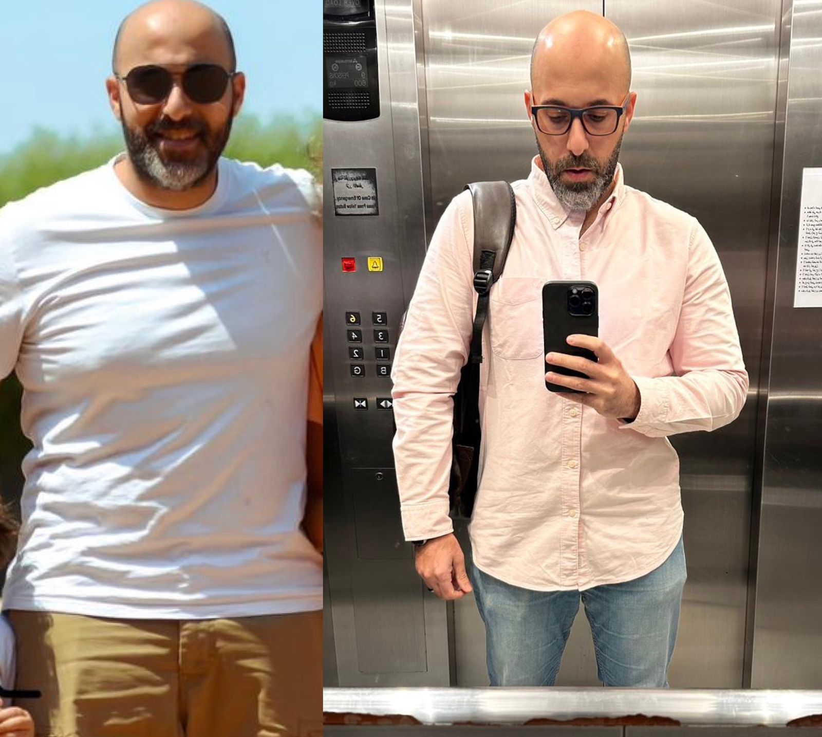 Transformation 1
